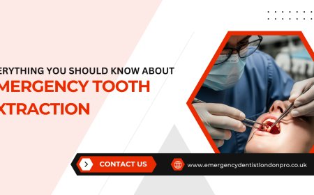 Everything You Should Know About Emergency Tooth Extraction