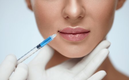 Lip Fillers Dubai: Can You Correct Lip Filler Injections If You’re Not Satisfied with the Results