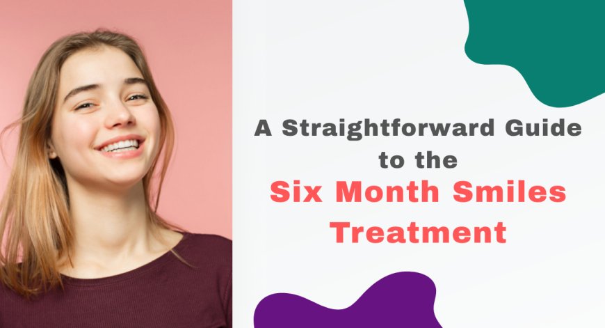 A Straightforward Guide to the Six Month Smiles Treatment