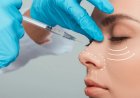 Choosing the Right Surgeon for Plastic Nose Surgery in Islamabad