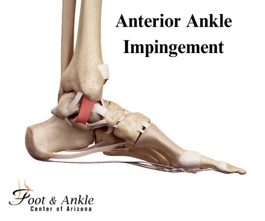 Anterior Ankle Impingement: Safe Stretches You Can Try Now